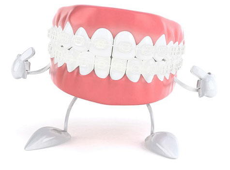 Ce trebuie să afli despre coroanele dentare?